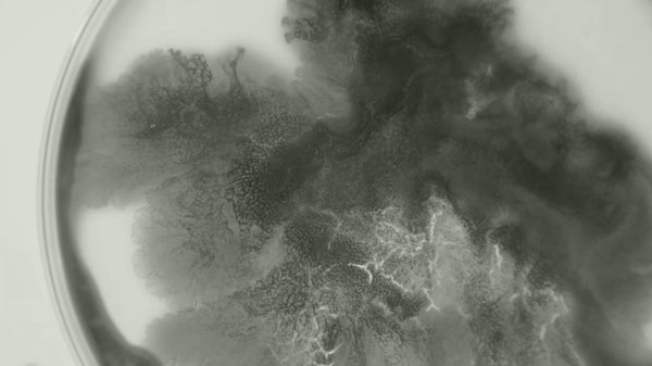 Hvad man kan forvente