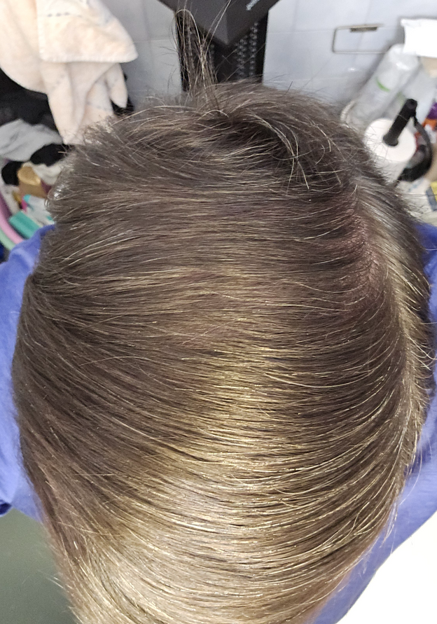 After