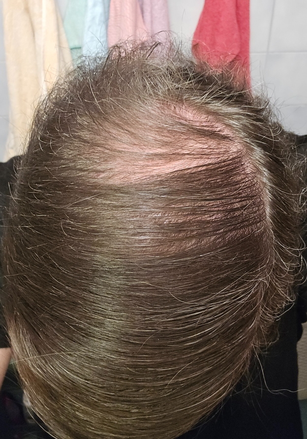 Before