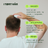 Scalp Massager