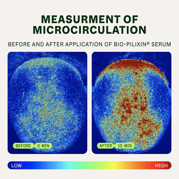 Bio-Pilixin® Refill Cartridge for Hairline Booster