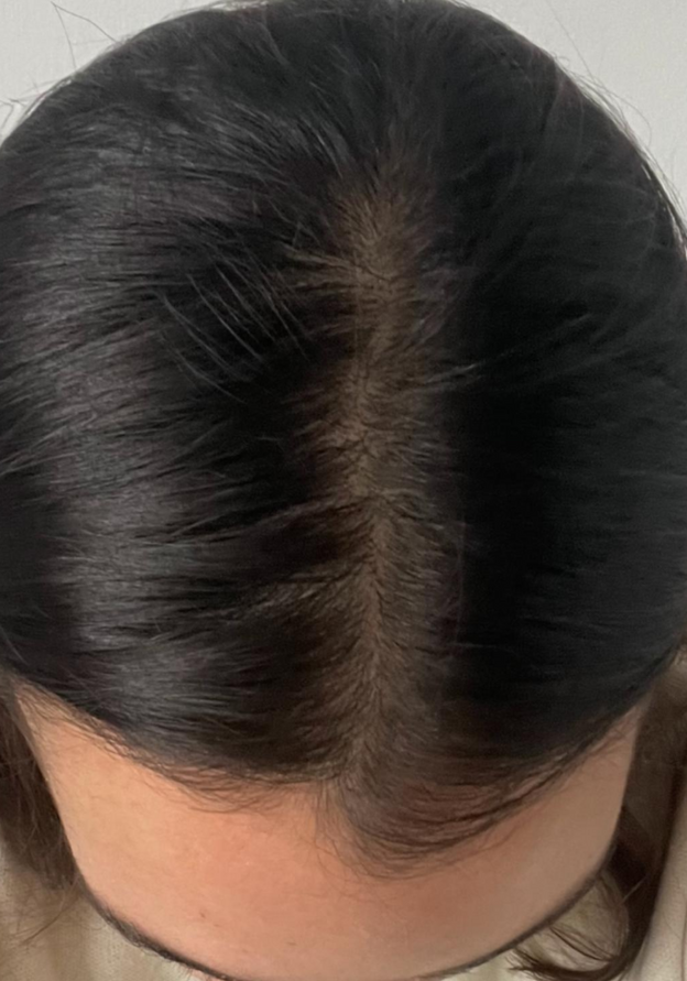 After - Rafaella Nieto
