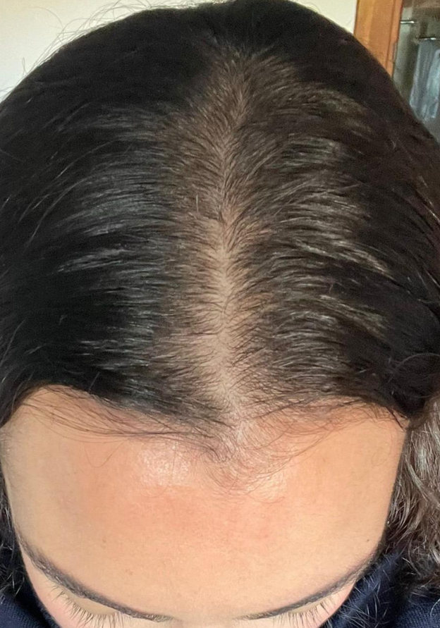Before - Rafaella Nieto
